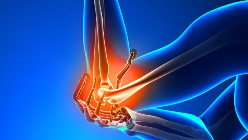 Артралгия локтевого сустава симптомы и лечение