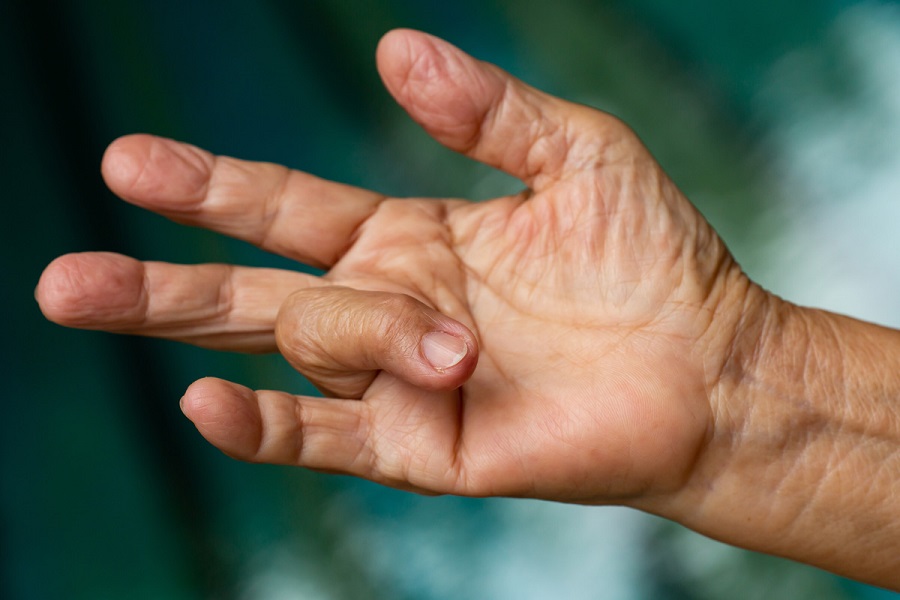 Триггерный палец: что это такое, причины, симптомы и лечение