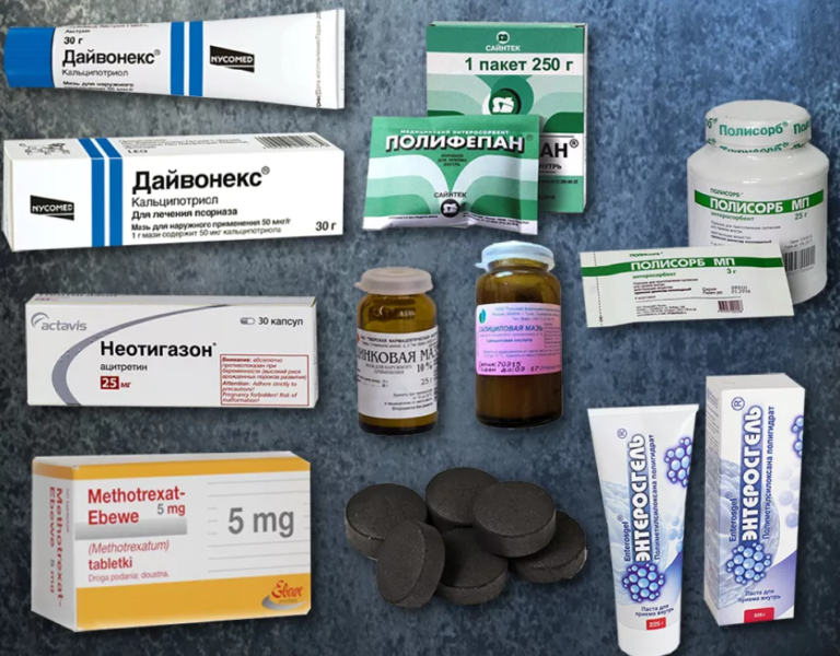 Псориаз на локтях: причины, как вылечить псориаз на локтях