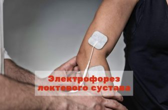 электрофорез локтевого сустава